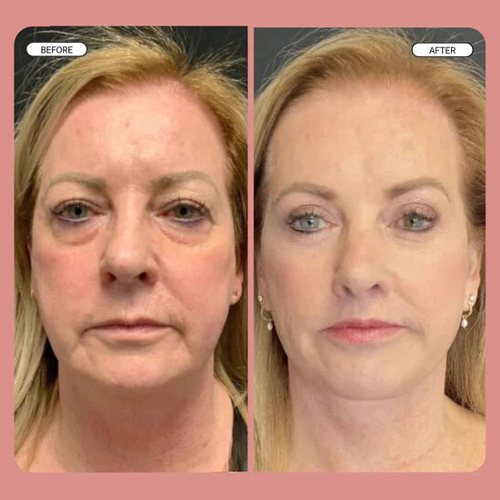 Instant FIRMx Temporary Face Tightener