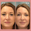 Instant FIRMx Temporary Face Tightener