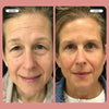 Instant FIRMx Temporary Face Tightener