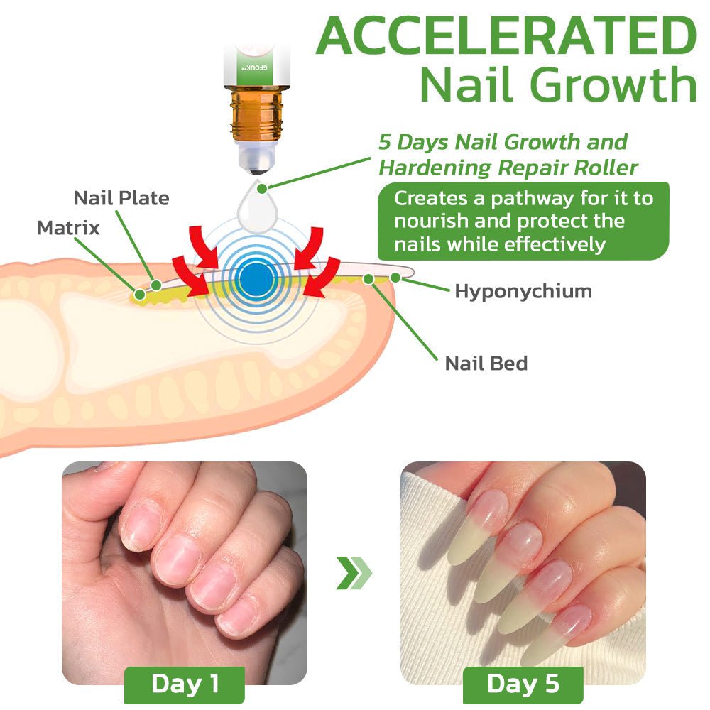 GFOUK™ 5 Days Nail Growth and Hardening Repair Roller - flowerence