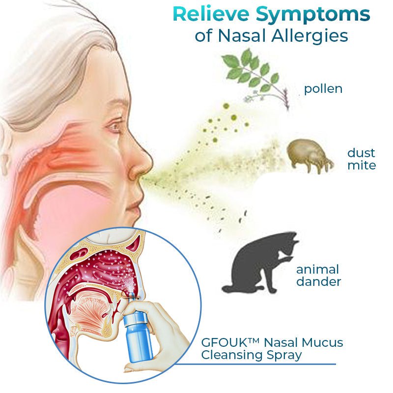 GFOUK™ Nasal Mucus Cleansing Spray - flowerence