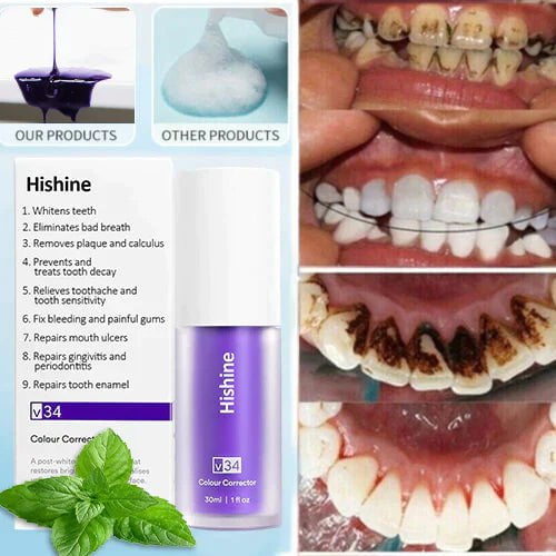Hishine™ Pure Herbal Teeth Whitening Mousse - flowerence