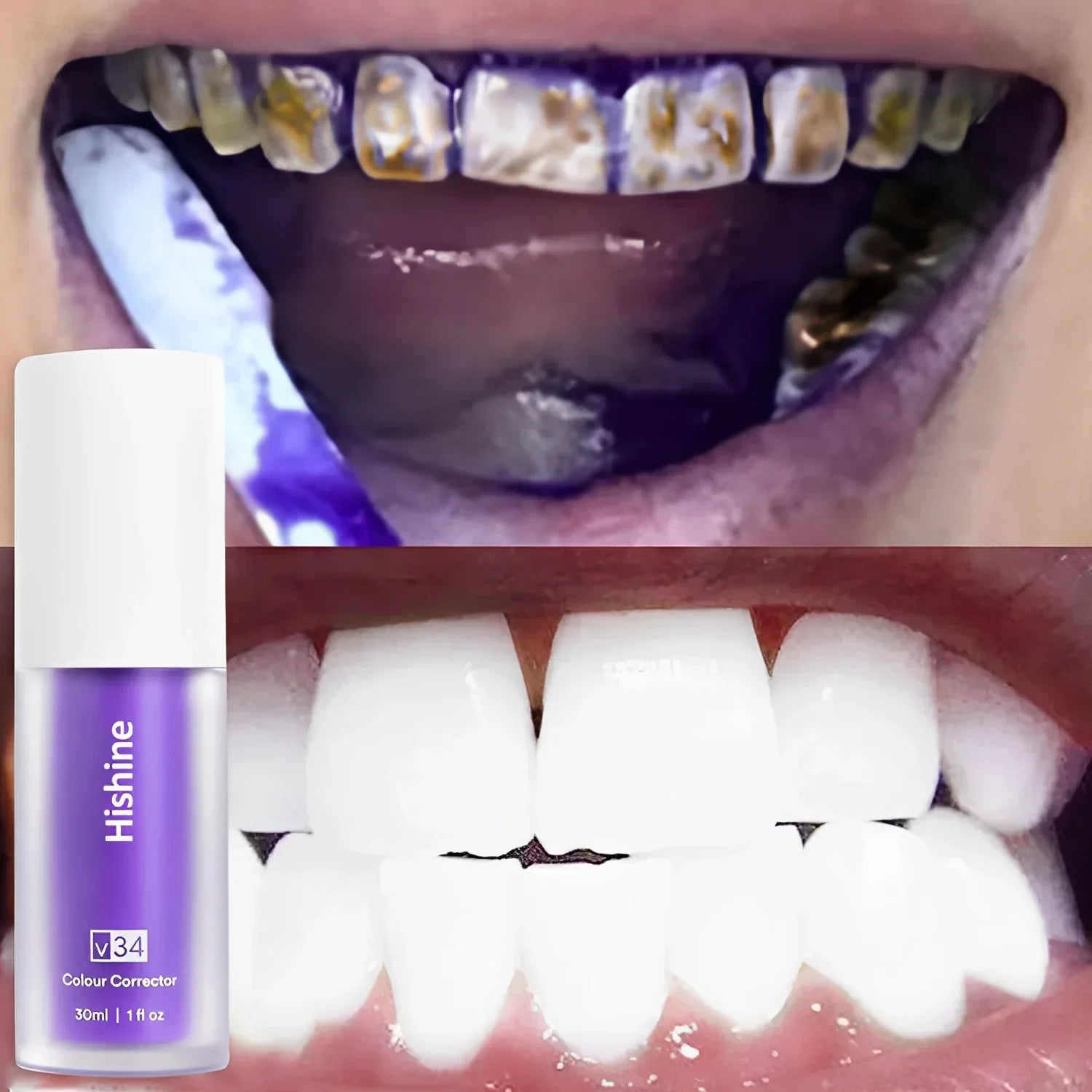 Hishine™ Pure Herbal Teeth Whitening Mousse - flowerence