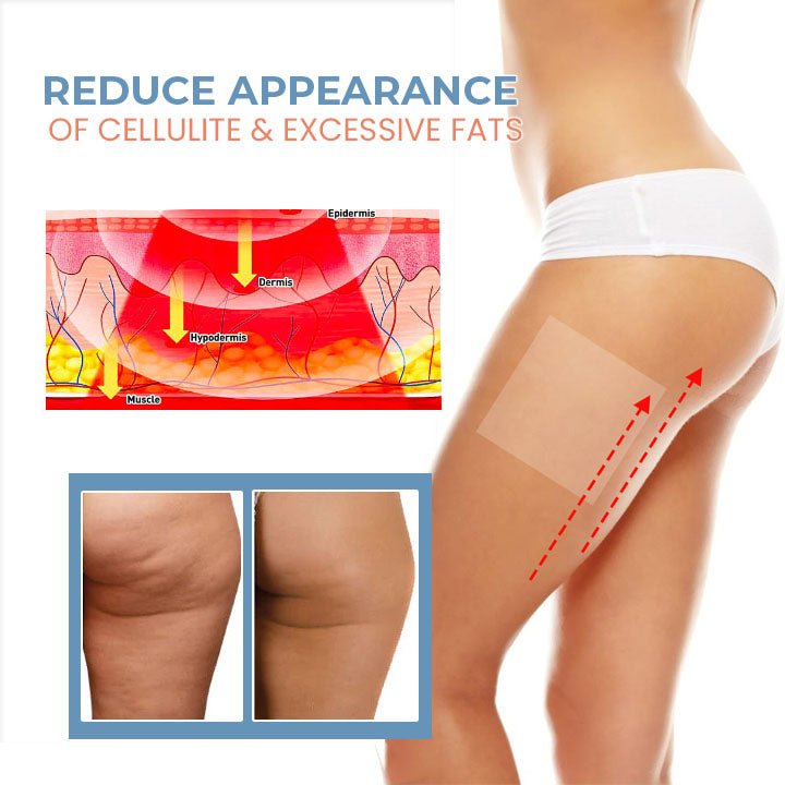 Oveallgo™ PRO TightenCell Anti-Cellulite Collagen Firming Patches - flowerence