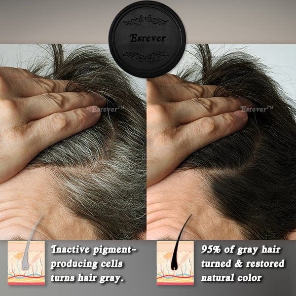 Esrever™ Rapid Gray Hair Reversing Fo-Ti Bar - flowerence