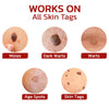 GFOUK™ WipeOff Tags And Moles Remover - flowerence