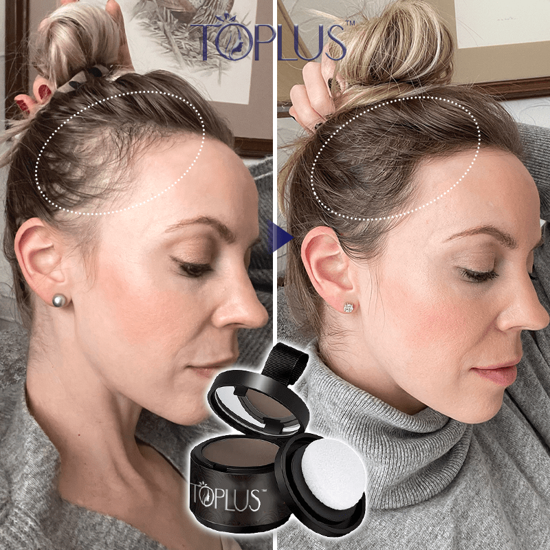 Toplus™ Premium Hairline Coverage Touch Up Powder - flowerence