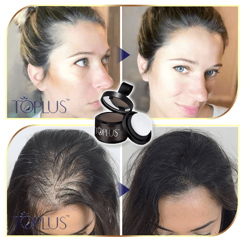 Toplus™ Premium Hairline Coverage Touch Up Powder - flowerence