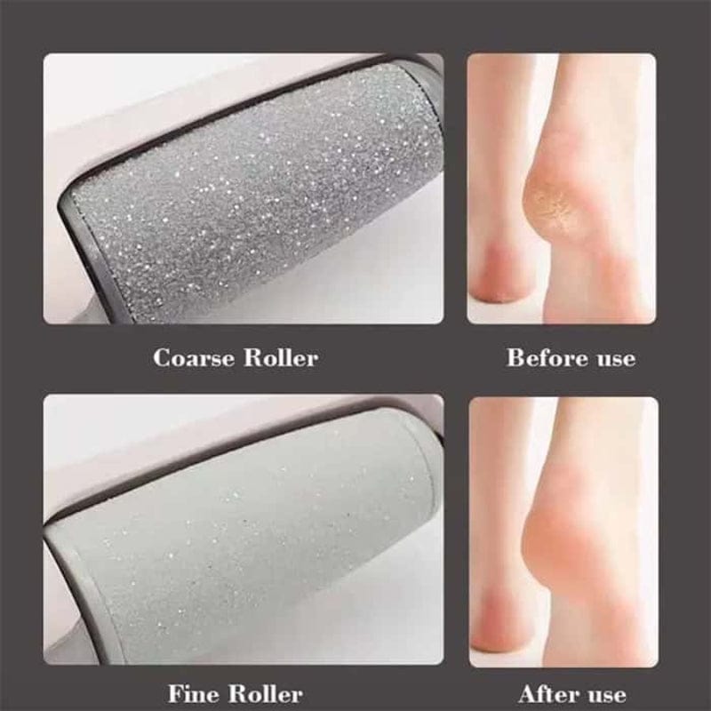 Flawless Pedi Electronic Tool File and Callus Remover