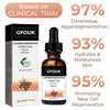 Load image into Gallery viewer, GFOUK™ Hyperpigmentation Correcting Facial Serum - flowerence